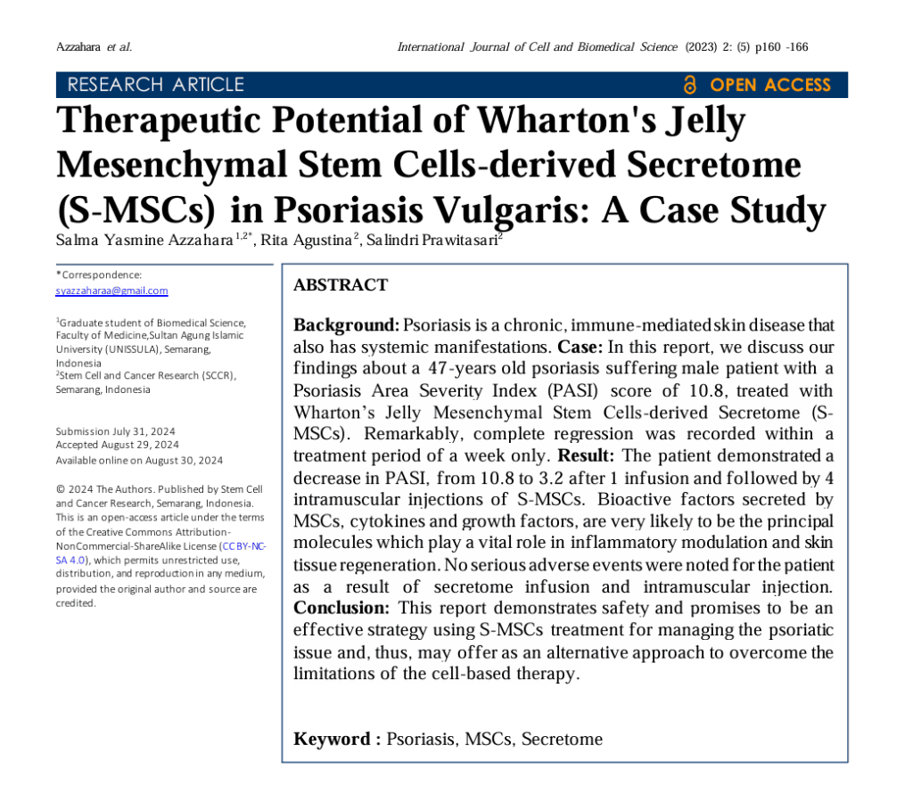 Therapeutic Potential of Wharton's JellyMesenchymal Stem Cells-derived Secretome(S-MSCs) in Psoriasis Vulgaris A Case Study